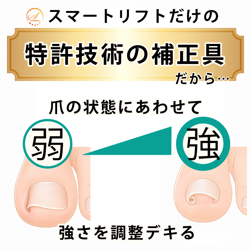 弱い巻き爪から強い巻き爪まで強度を調整できるイメージ