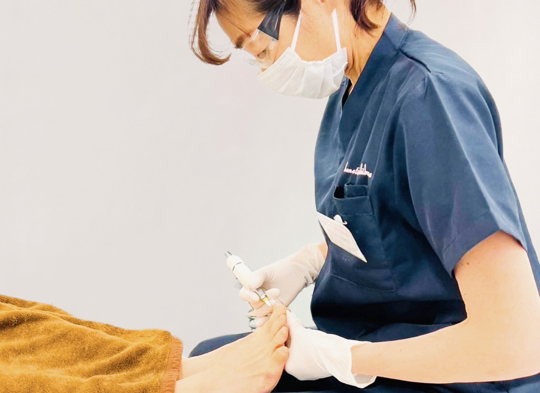 錦糸町巻き爪センターの巻き爪矯正